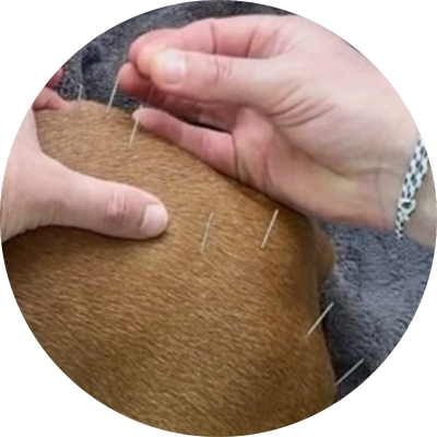 ACUPUNCTURE Therapy